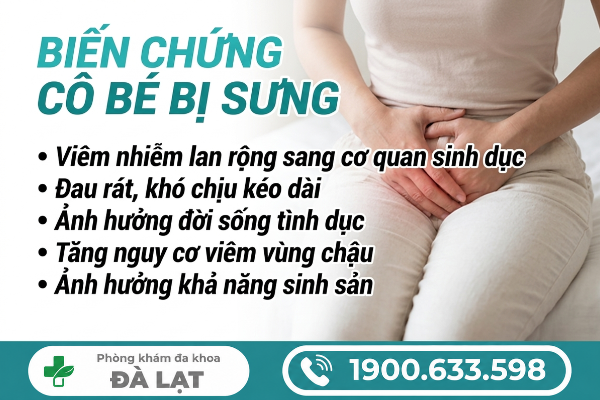 Hình ảnh minh họa